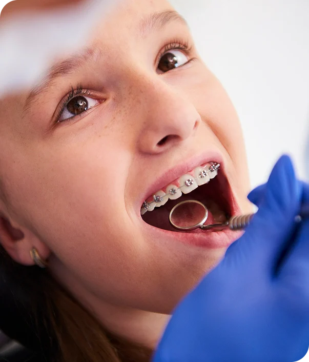 A child getting their braces on their teeth
